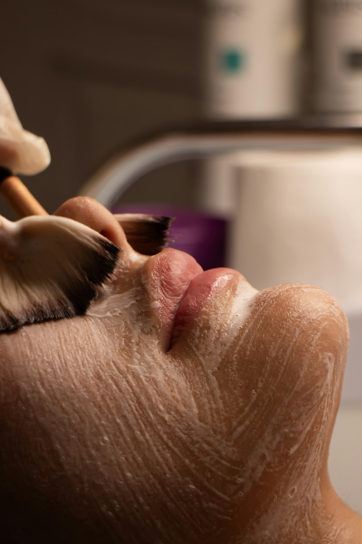 Acne & Scar Treatment at Enfield Royal Clinic Khalifa City