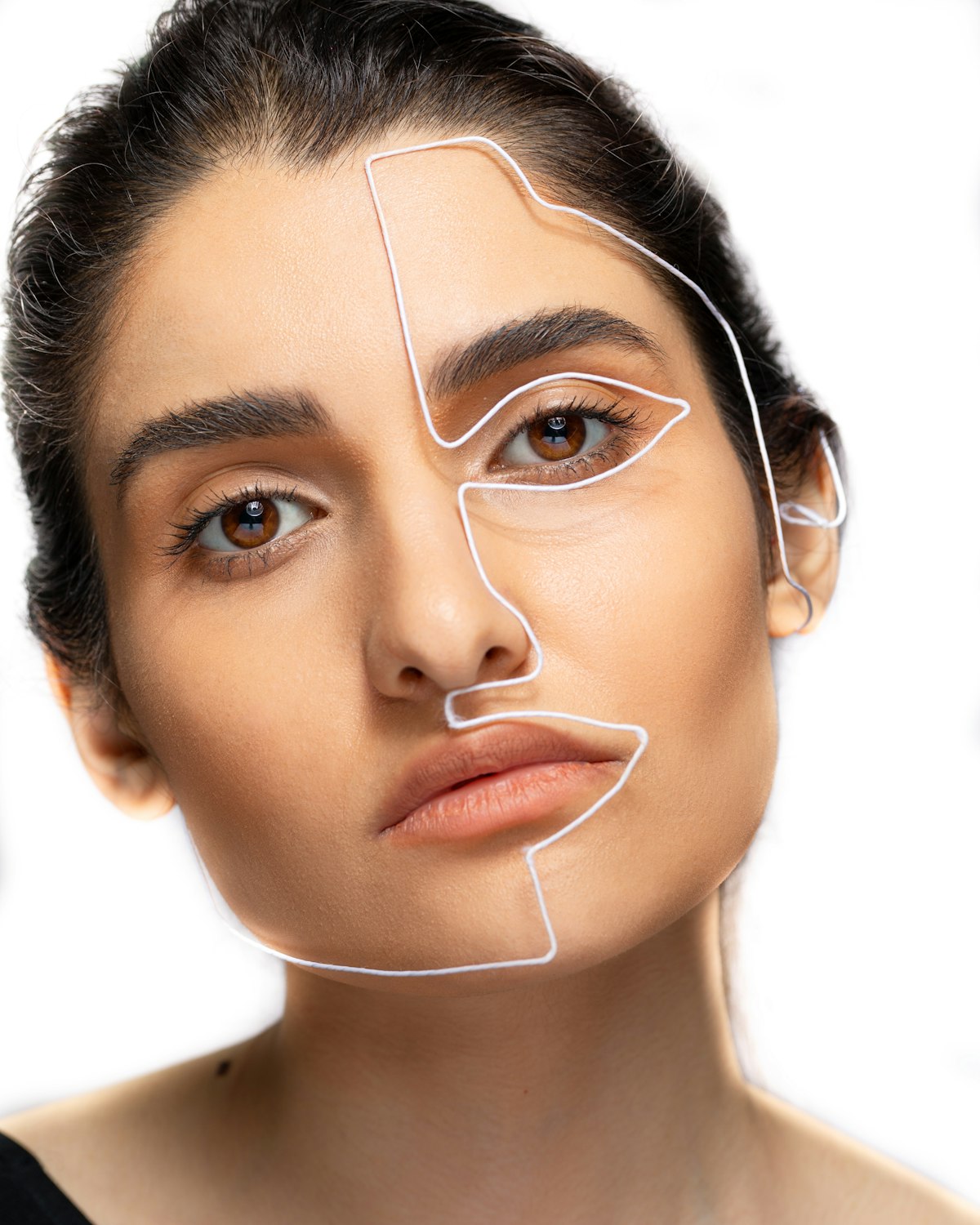 Cheek Fillers — Enfield Royal Clinic Khalifa City
