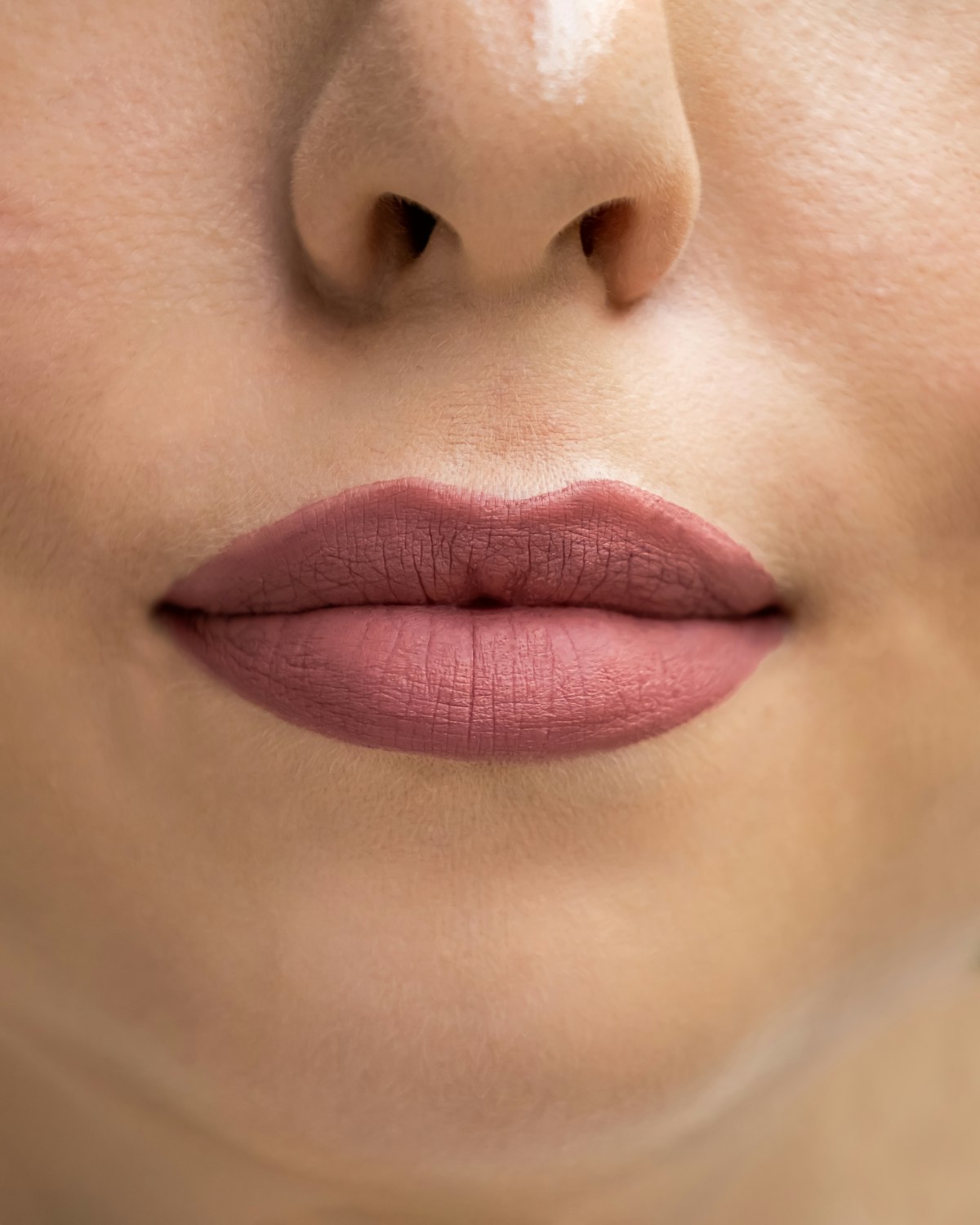 Lip Fillers at Enfield Royal Clinic Khalifa City