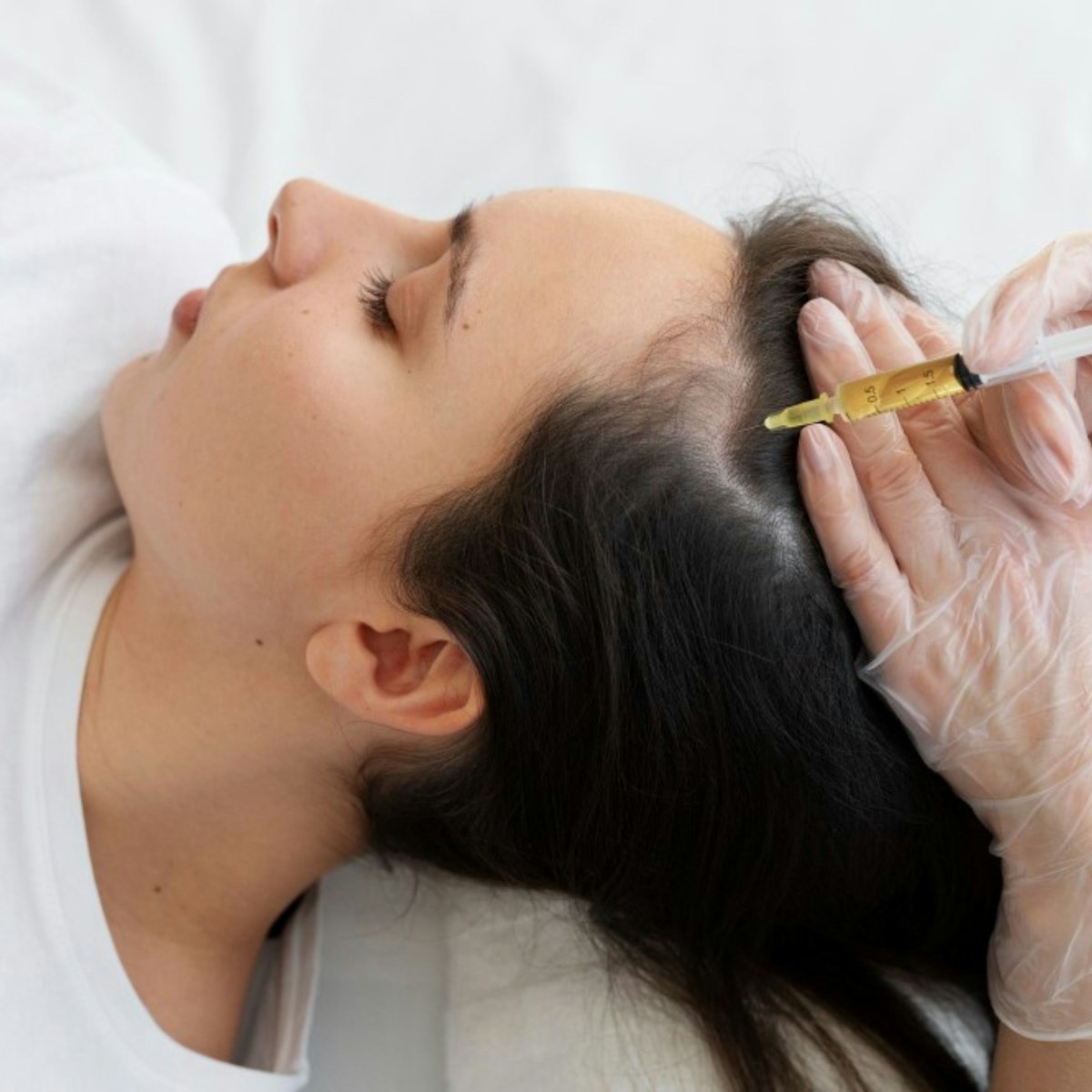 PRP for Hair Loss at Enfield Royal Clinic Khalifa City