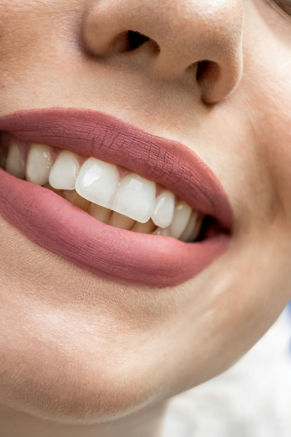 Teeth Whitening at Enfield Royal Clinic Khalifa City